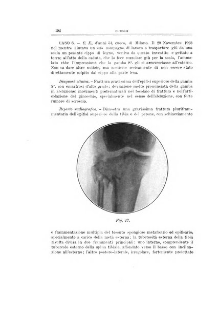 Archivio di ortopedia pubblicazione ufficiale del Pio istituto dei rachitici <1924-1950>