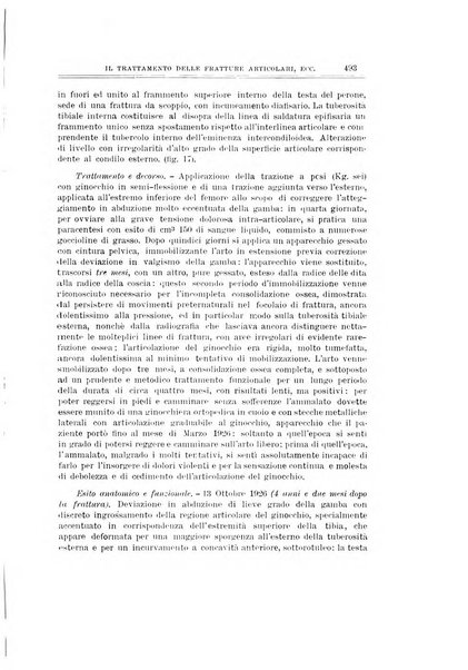 Archivio di ortopedia pubblicazione ufficiale del Pio istituto dei rachitici <1924-1950>