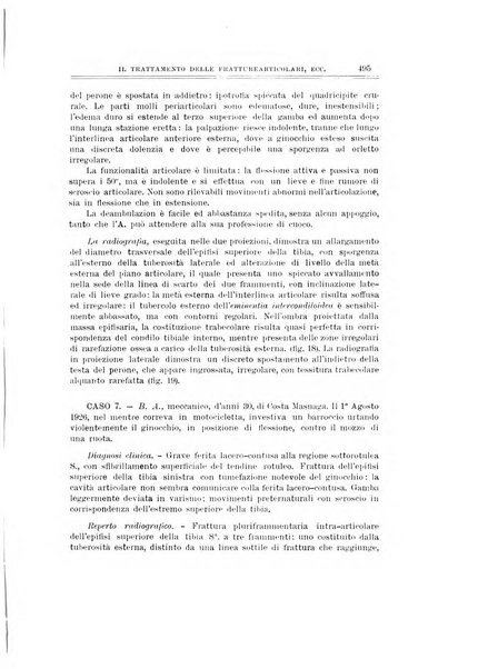 Archivio di ortopedia pubblicazione ufficiale del Pio istituto dei rachitici <1924-1950>