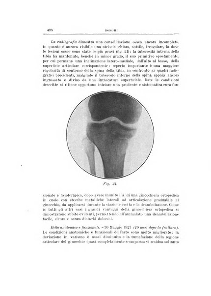 Archivio di ortopedia pubblicazione ufficiale del Pio istituto dei rachitici <1924-1950>