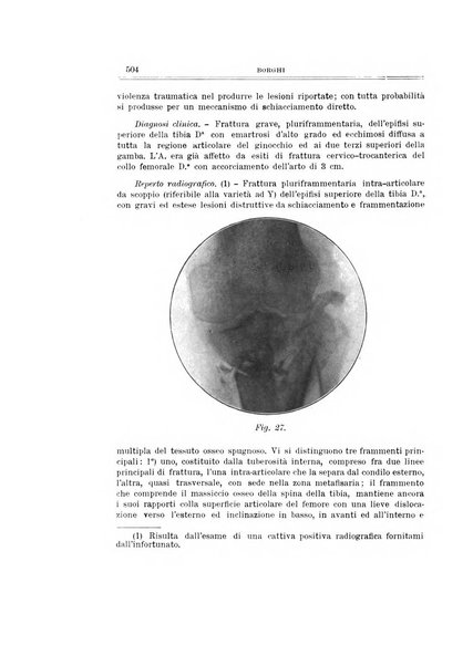 Archivio di ortopedia pubblicazione ufficiale del Pio istituto dei rachitici <1924-1950>