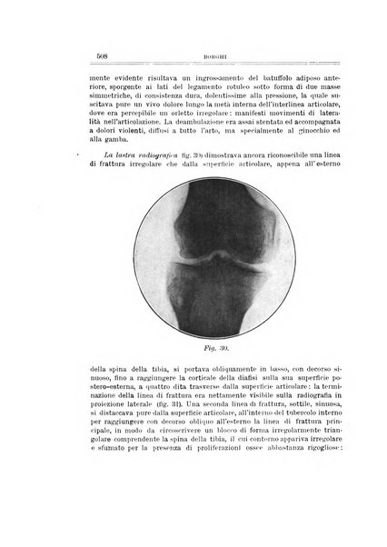 Archivio di ortopedia pubblicazione ufficiale del Pio istituto dei rachitici <1924-1950>