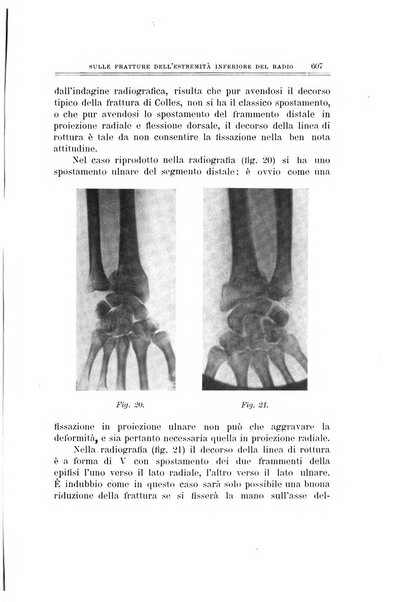 Archivio di ortopedia pubblicazione ufficiale del Pio istituto dei rachitici <1924-1950>