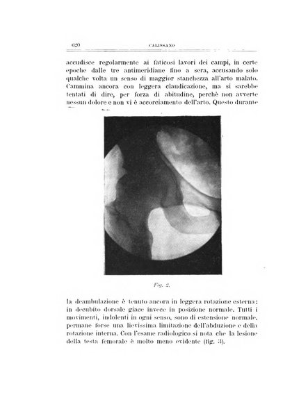 Archivio di ortopedia pubblicazione ufficiale del Pio istituto dei rachitici <1924-1950>