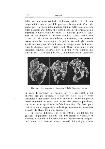 Archivio di ortopedia pubblicazione ufficiale del Pio istituto dei rachitici <1924-1950>