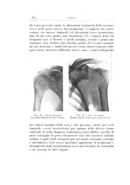 Archivio di ortopedia pubblicazione ufficiale del Pio istituto dei rachitici <1924-1950>