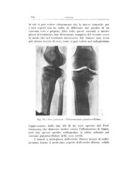 Archivio di ortopedia pubblicazione ufficiale del Pio istituto dei rachitici <1924-1950>