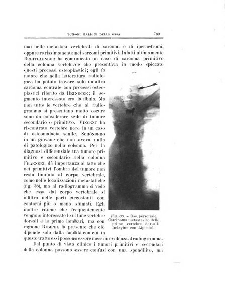 Archivio di ortopedia pubblicazione ufficiale del Pio istituto dei rachitici <1924-1950>