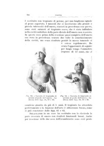 Archivio di ortopedia pubblicazione ufficiale del Pio istituto dei rachitici <1924-1950>