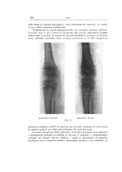 Archivio di ortopedia pubblicazione ufficiale del Pio istituto dei rachitici <1924-1950>