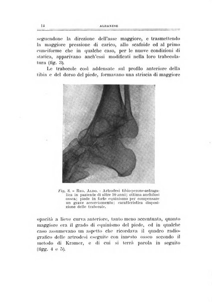 Archivio di ortopedia pubblicazione ufficiale del Pio istituto dei rachitici <1924-1950>