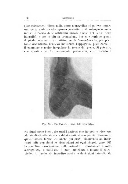 Archivio di ortopedia pubblicazione ufficiale del Pio istituto dei rachitici <1924-1950>