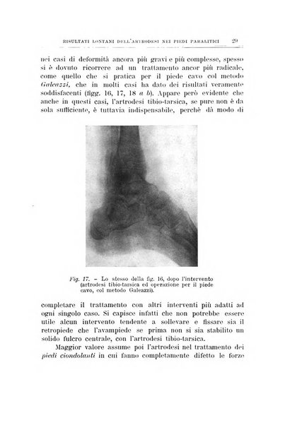 Archivio di ortopedia pubblicazione ufficiale del Pio istituto dei rachitici <1924-1950>