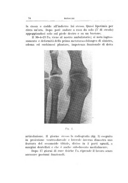 Archivio di ortopedia pubblicazione ufficiale del Pio istituto dei rachitici <1924-1950>