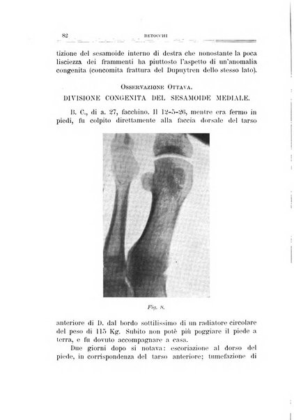 Archivio di ortopedia pubblicazione ufficiale del Pio istituto dei rachitici <1924-1950>