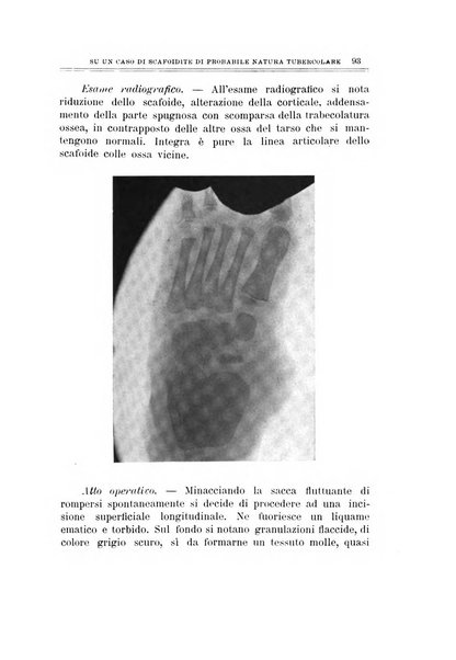 Archivio di ortopedia pubblicazione ufficiale del Pio istituto dei rachitici <1924-1950>