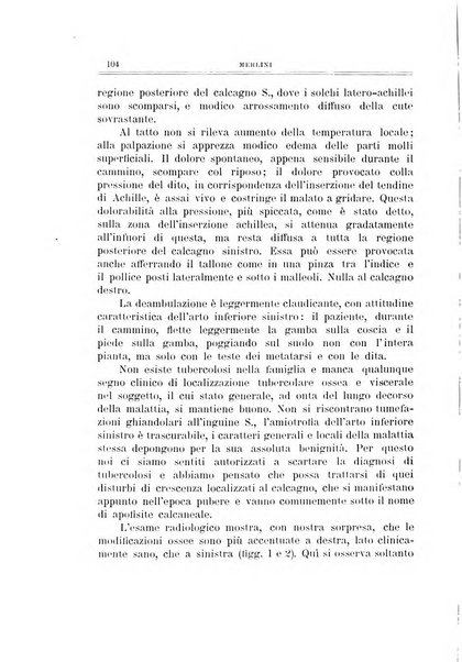 Archivio di ortopedia pubblicazione ufficiale del Pio istituto dei rachitici <1924-1950>