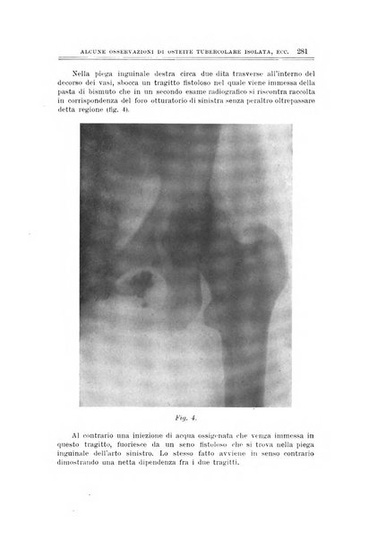 Archivio di ortopedia pubblicazione ufficiale del Pio istituto dei rachitici <1924-1950>