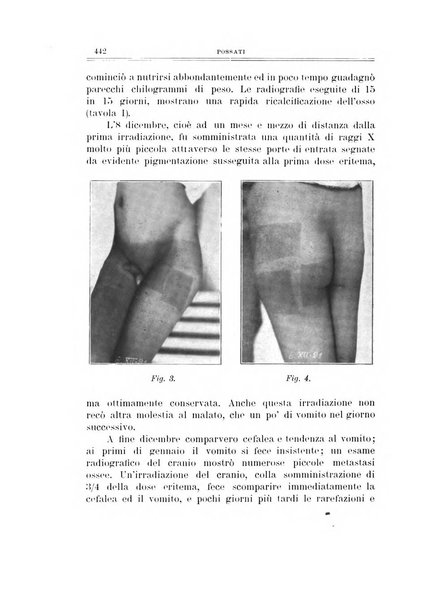 Archivio di ortopedia pubblicazione ufficiale del Pio istituto dei rachitici <1924-1950>