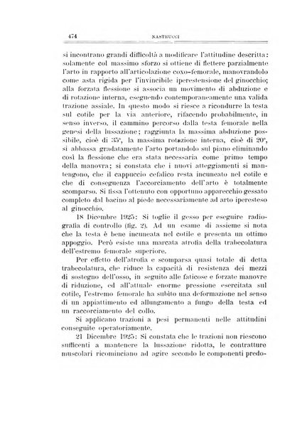 Archivio di ortopedia pubblicazione ufficiale del Pio istituto dei rachitici <1924-1950>