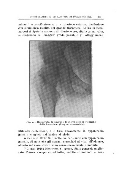 Archivio di ortopedia pubblicazione ufficiale del Pio istituto dei rachitici <1924-1950>