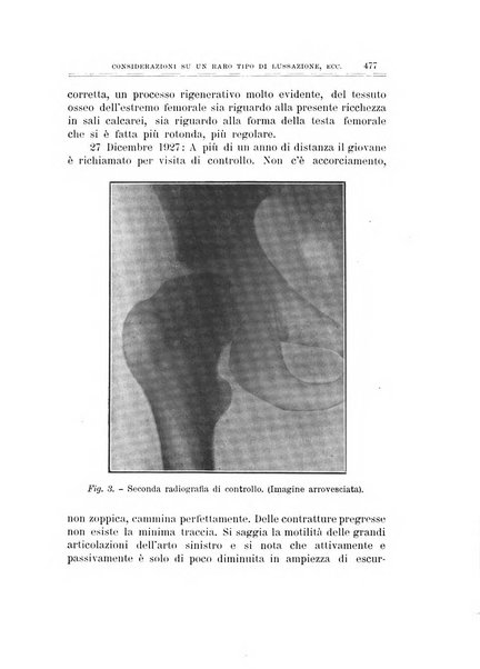 Archivio di ortopedia pubblicazione ufficiale del Pio istituto dei rachitici <1924-1950>