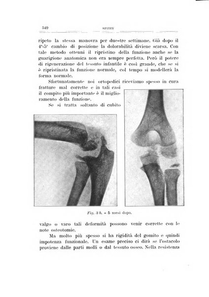 Archivio di ortopedia pubblicazione ufficiale del Pio istituto dei rachitici <1924-1950>