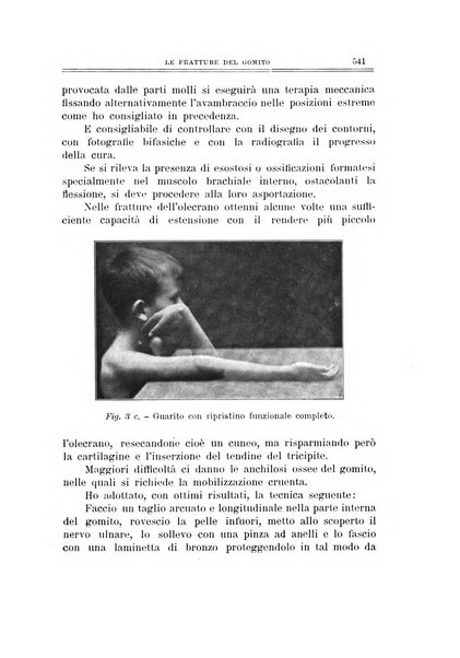 Archivio di ortopedia pubblicazione ufficiale del Pio istituto dei rachitici <1924-1950>