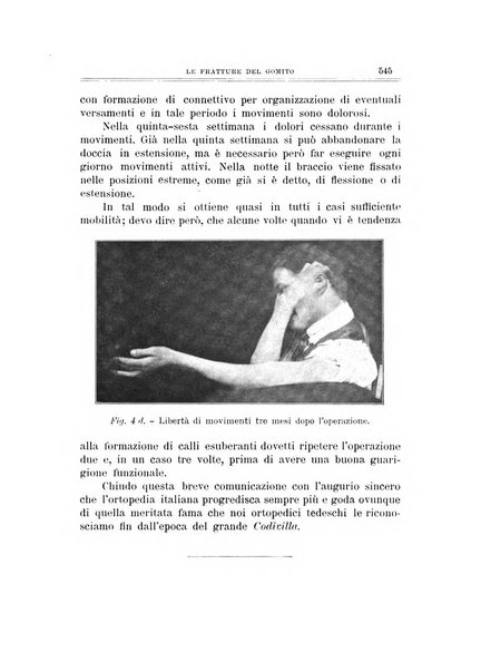 Archivio di ortopedia pubblicazione ufficiale del Pio istituto dei rachitici <1924-1950>