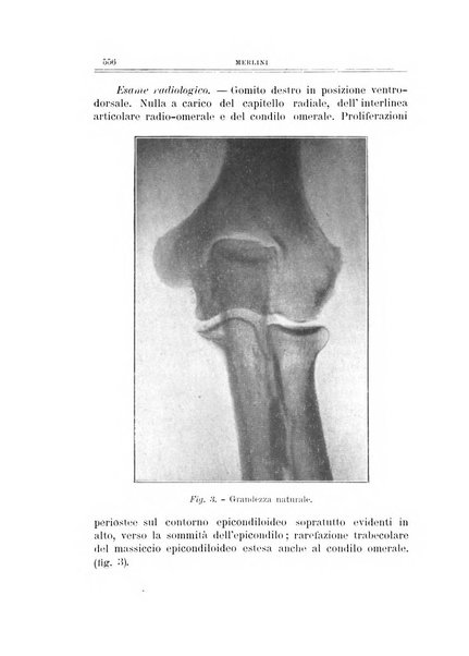 Archivio di ortopedia pubblicazione ufficiale del Pio istituto dei rachitici <1924-1950>