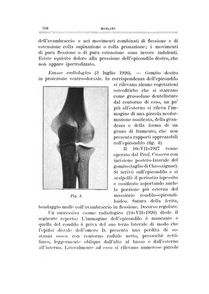 Archivio di ortopedia pubblicazione ufficiale del Pio istituto dei rachitici <1924-1950>