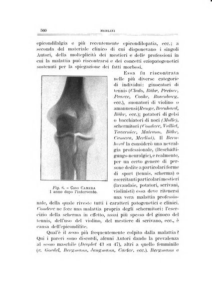 Archivio di ortopedia pubblicazione ufficiale del Pio istituto dei rachitici <1924-1950>