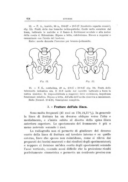 Archivio di ortopedia pubblicazione ufficiale del Pio istituto dei rachitici <1924-1950>