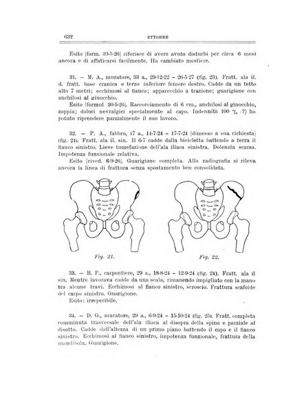 Archivio di ortopedia pubblicazione ufficiale del Pio istituto dei rachitici <1924-1950>