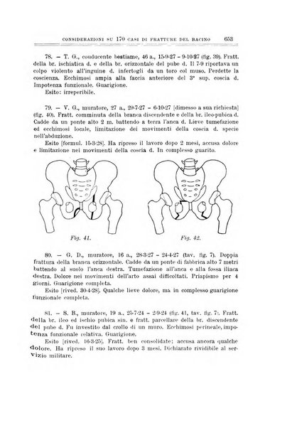 Archivio di ortopedia pubblicazione ufficiale del Pio istituto dei rachitici <1924-1950>