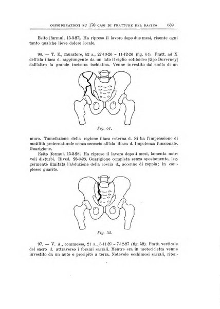 Archivio di ortopedia pubblicazione ufficiale del Pio istituto dei rachitici <1924-1950>