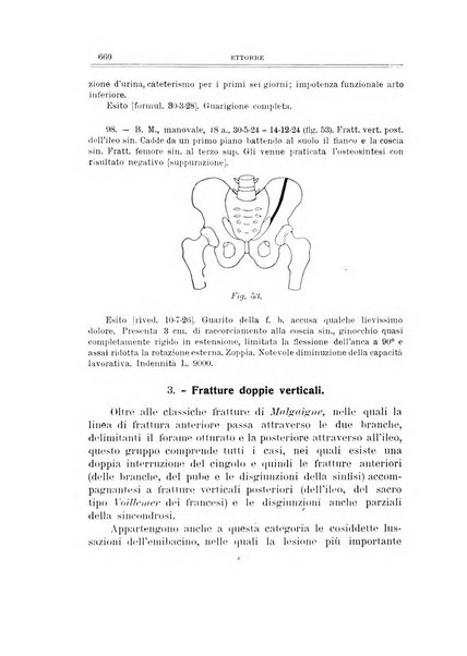 Archivio di ortopedia pubblicazione ufficiale del Pio istituto dei rachitici <1924-1950>