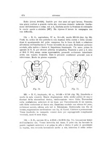 Archivio di ortopedia pubblicazione ufficiale del Pio istituto dei rachitici <1924-1950>