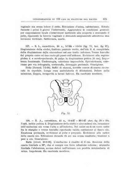 Archivio di ortopedia pubblicazione ufficiale del Pio istituto dei rachitici <1924-1950>