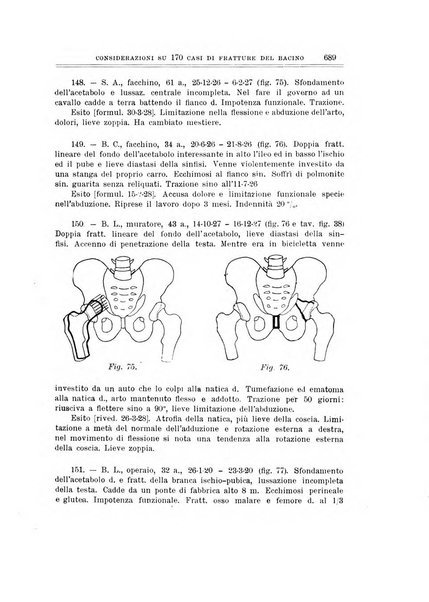 Archivio di ortopedia pubblicazione ufficiale del Pio istituto dei rachitici <1924-1950>