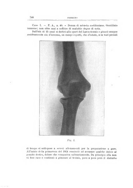 Archivio di ortopedia pubblicazione ufficiale del Pio istituto dei rachitici <1924-1950>