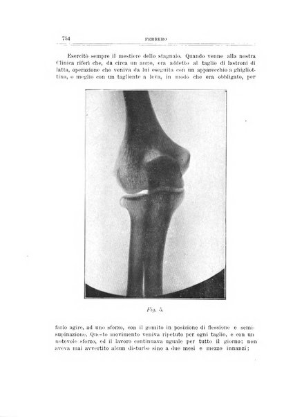 Archivio di ortopedia pubblicazione ufficiale del Pio istituto dei rachitici <1924-1950>