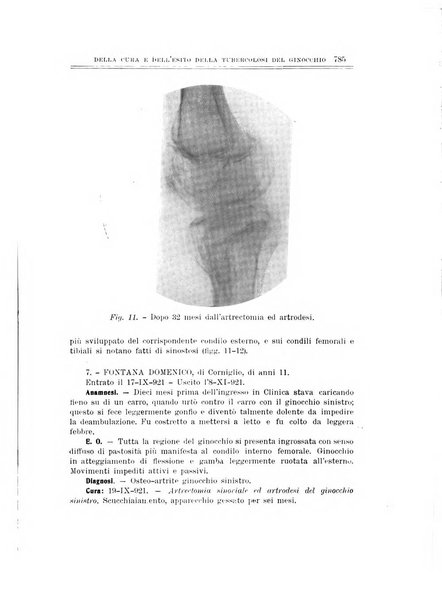 Archivio di ortopedia pubblicazione ufficiale del Pio istituto dei rachitici <1924-1950>