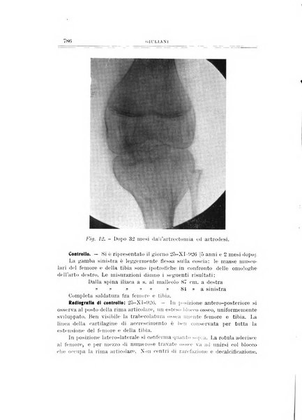 Archivio di ortopedia pubblicazione ufficiale del Pio istituto dei rachitici <1924-1950>