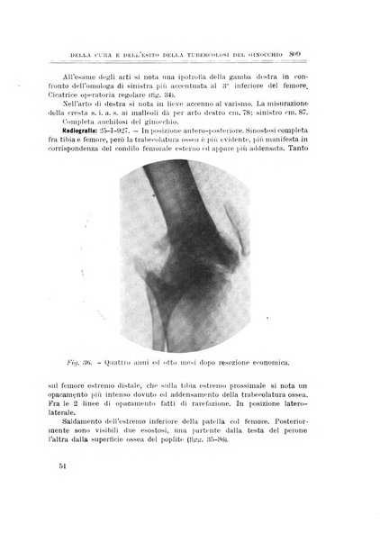 Archivio di ortopedia pubblicazione ufficiale del Pio istituto dei rachitici <1924-1950>