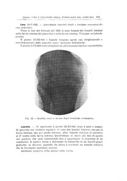 Archivio di ortopedia pubblicazione ufficiale del Pio istituto dei rachitici <1924-1950>