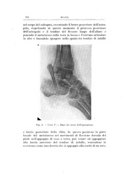 Archivio di ortopedia pubblicazione ufficiale del Pio istituto dei rachitici <1924-1950>