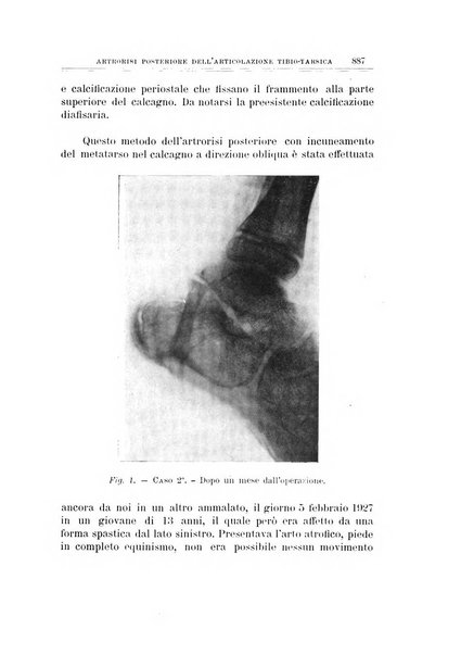 Archivio di ortopedia pubblicazione ufficiale del Pio istituto dei rachitici <1924-1950>