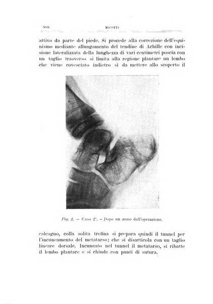 Archivio di ortopedia pubblicazione ufficiale del Pio istituto dei rachitici <1924-1950>