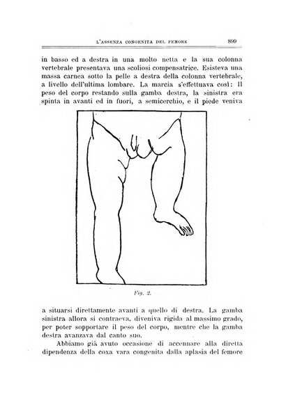 Archivio di ortopedia pubblicazione ufficiale del Pio istituto dei rachitici <1924-1950>